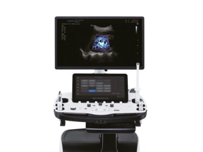 Samsung’s premier ultrasound machine RS85 Prestige